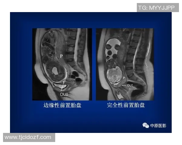 约维奇重摔受伤退场X光检查结果无异常明日将进行MRI检查评估伤情